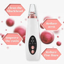 Aparelho Para Remover Cravos e Espinhas - Aifeli - Loja para todas as mulheres